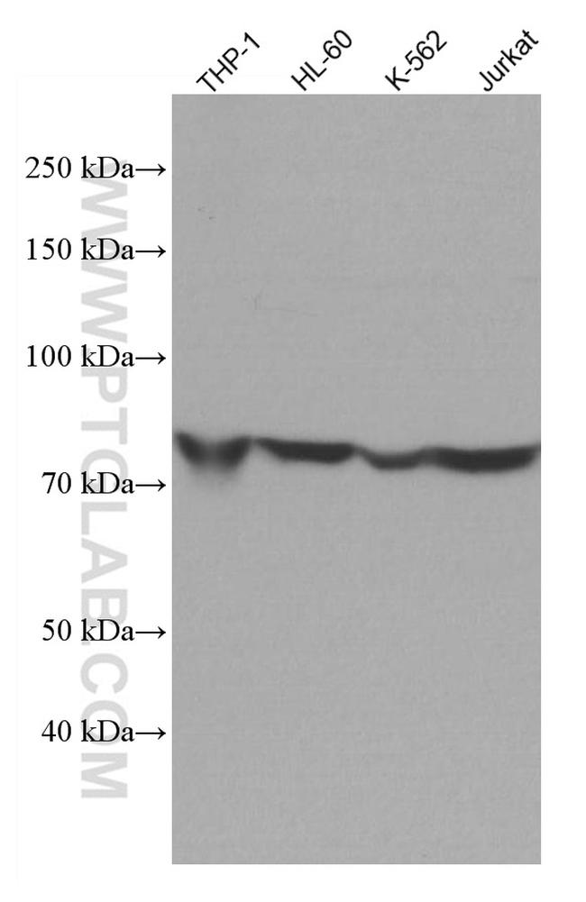 ADRBK1 Antibody in Western Blot (WB)