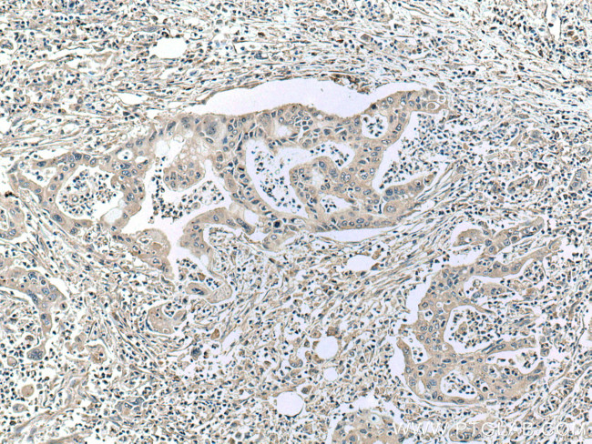 ASK1 Antibody in Immunohistochemistry (Paraffin) (IHC (P))