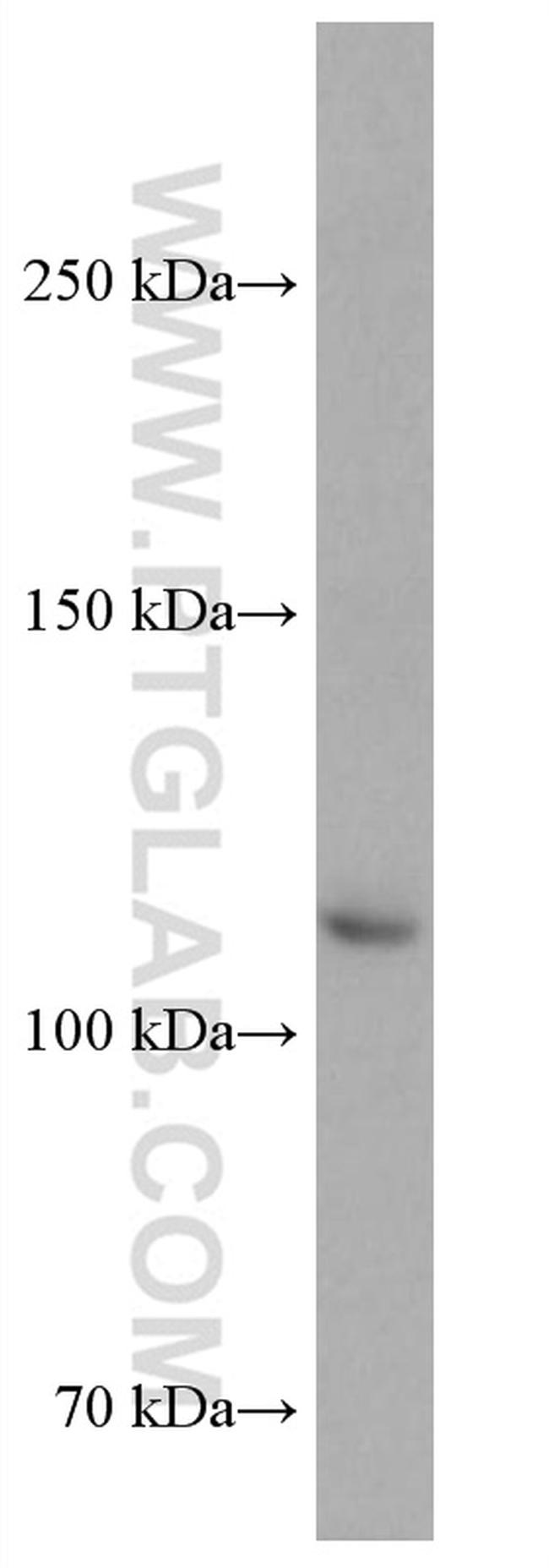 ASK1 Antibody in Western Blot (WB)