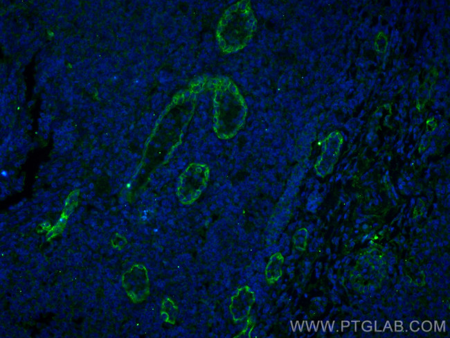 Endoglin/CD105 Antibody in Immunohistochemistry (PFA fixed) (IHC (PFA))