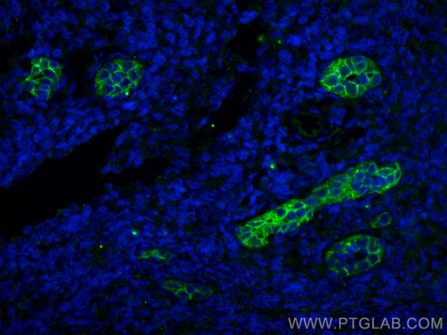 Endoglin/CD105 Antibody in Immunohistochemistry (PFA fixed) (IHC (PFA))