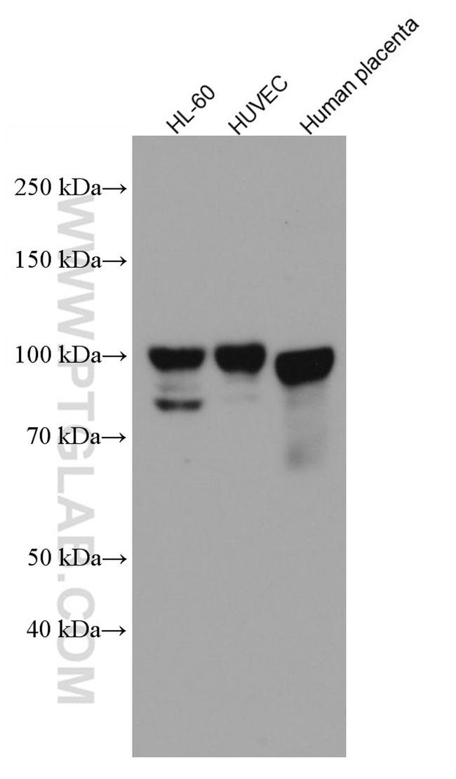 Endoglin/CD105 Antibody in Western Blot (WB)