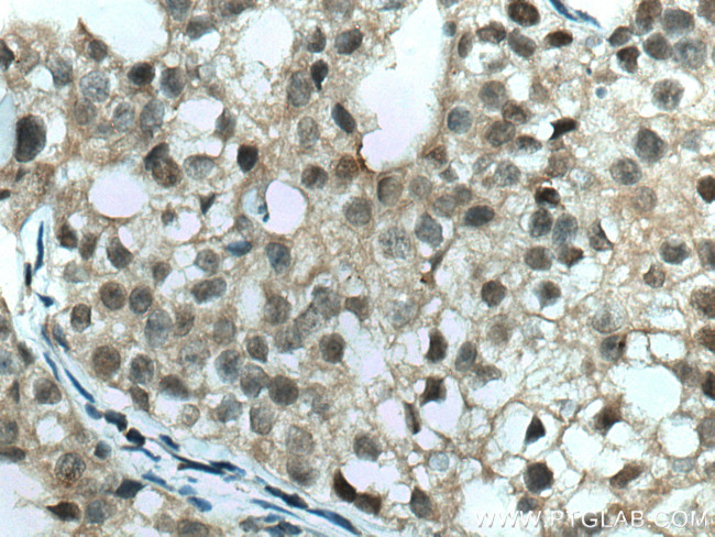 TFAP2A/AP-2 Antibody in Immunohistochemistry (Paraffin) (IHC (P))