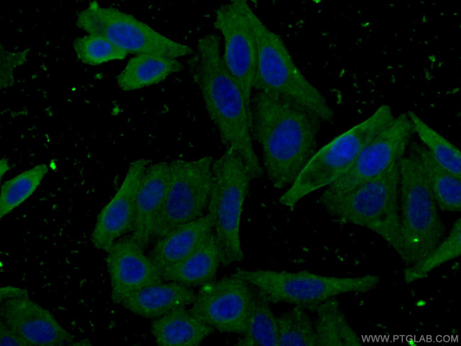 CES1 Antibody in Immunocytochemistry (ICC/IF)