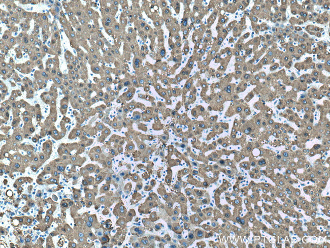 CES1 Antibody in Immunohistochemistry (Paraffin) (IHC (P))