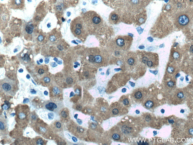 CES1 Antibody in Immunohistochemistry (Paraffin) (IHC (P))