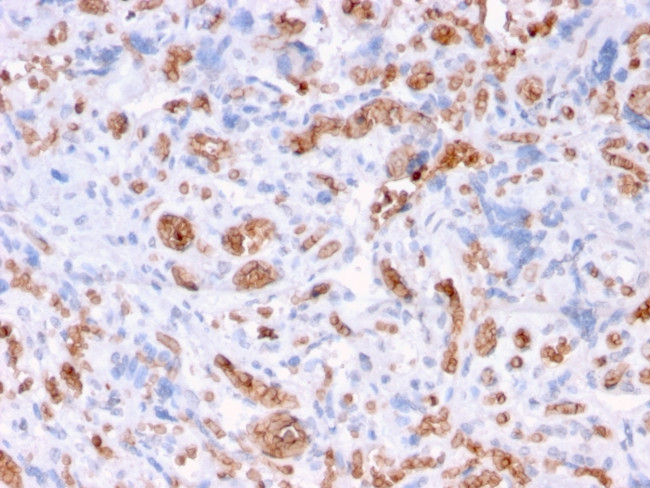 Spectrin Alpha 1 (Erythrocyte Marker) Antibody in Immunohistochemistry (Paraffin) (IHC (P))