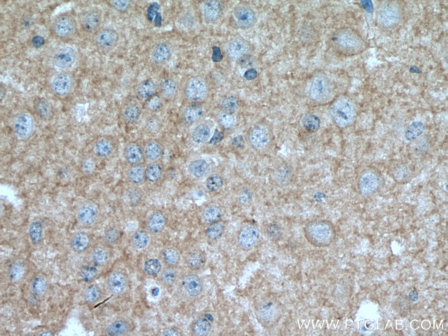 EAAT2 Antibody in Immunohistochemistry (Paraffin) (IHC (P))