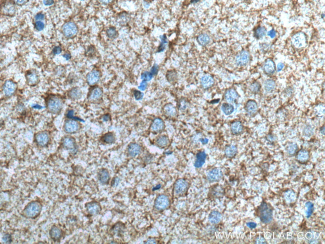 EAAT2 Antibody in Immunohistochemistry (Paraffin) (IHC (P))