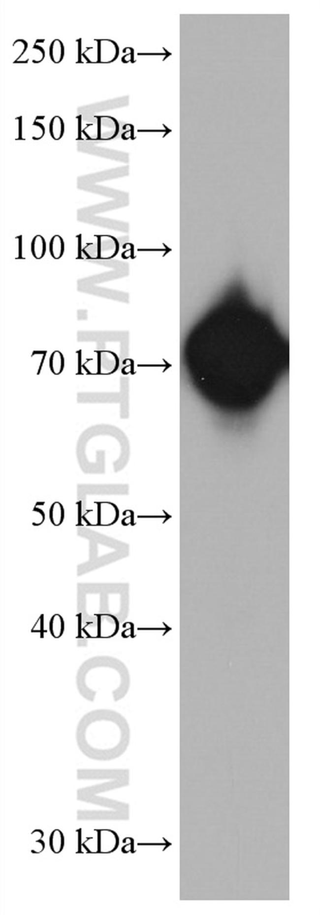 RUNX1T1 Antibody in Western Blot (WB)