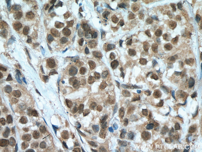 HORMAD1 Antibody in Immunohistochemistry (Paraffin) (IHC (P))