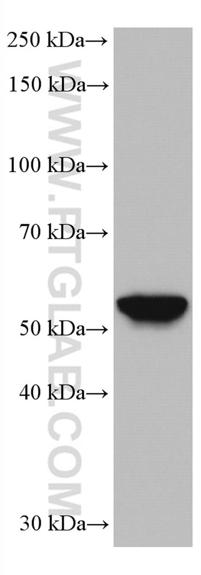 HORMAD1 Antibody in Western Blot (WB)