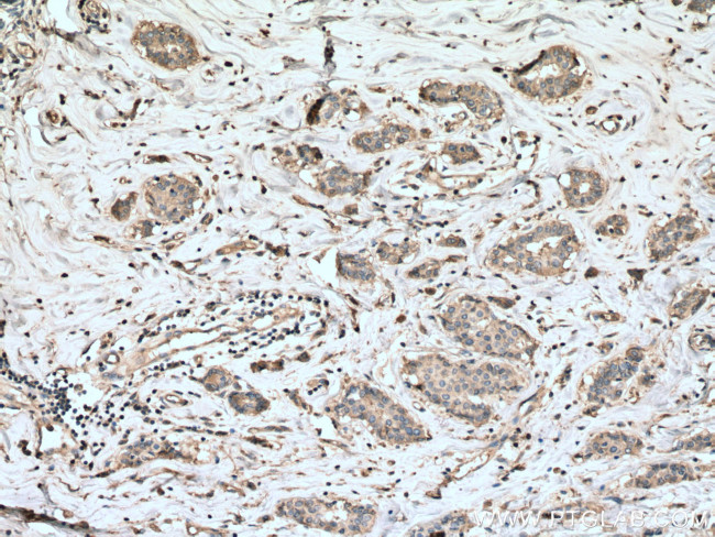 RALA Antibody in Immunohistochemistry (Paraffin) (IHC (P))