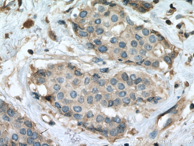 RALA Antibody in Immunohistochemistry (Paraffin) (IHC (P))