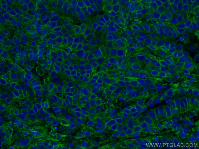 RALB Antibody in Immunohistochemistry (Paraffin) (IHC (P))