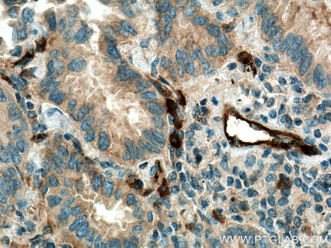 RALB Antibody in Immunohistochemistry (Paraffin) (IHC (P))