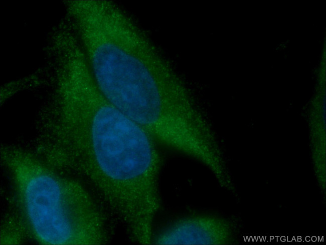 ATG9A Antibody in Immunocytochemistry (ICC/IF)