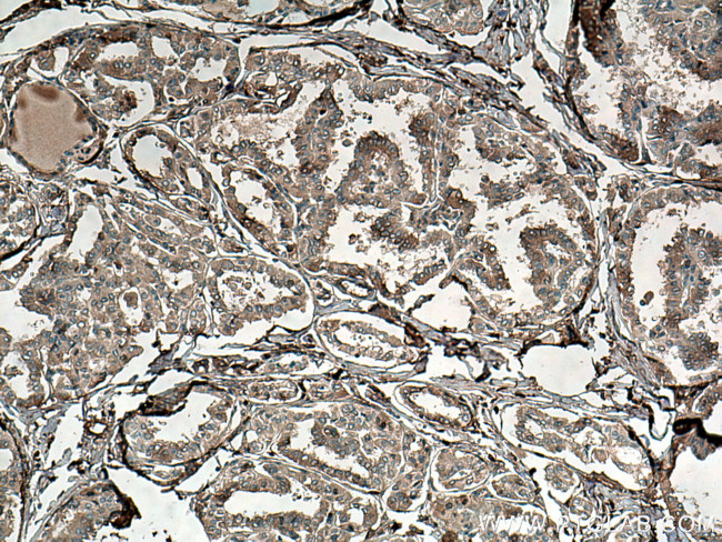 ATG9A Antibody in Immunohistochemistry (Paraffin) (IHC (P))