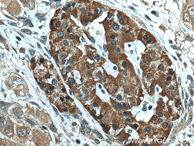 NEU3 Antibody in Immunohistochemistry (Paraffin) (IHC (P))