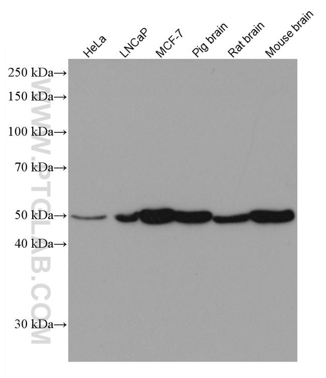 PICK1 Antibody in Western Blot (WB)