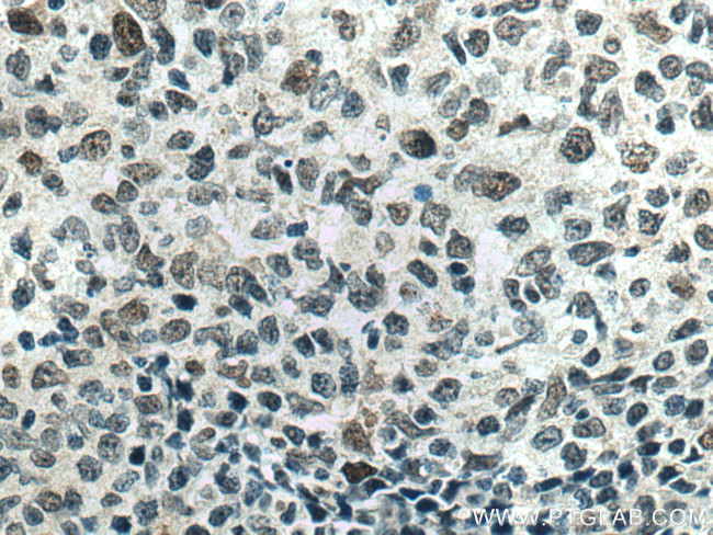 MAD2L2 Antibody in Immunohistochemistry (Paraffin) (IHC (P))