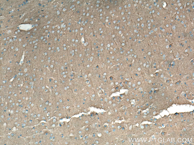 DLG3 Antibody in Immunohistochemistry (Paraffin) (IHC (P))