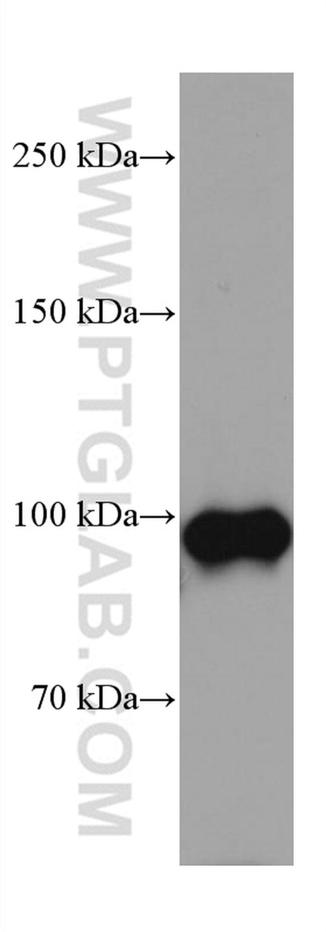 DLG3 Antibody in Western Blot (WB)