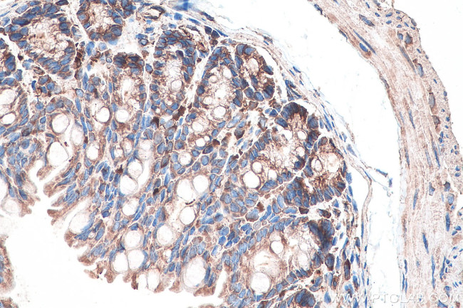 DVL2 Antibody in Immunohistochemistry (Paraffin) (IHC (P))