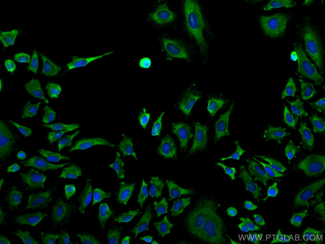 Calpastatin Antibody in Immunocytochemistry (ICC/IF)