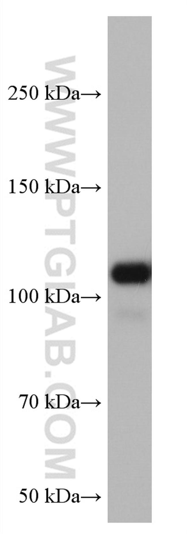 VAV2 Antibody in Western Blot (WB)