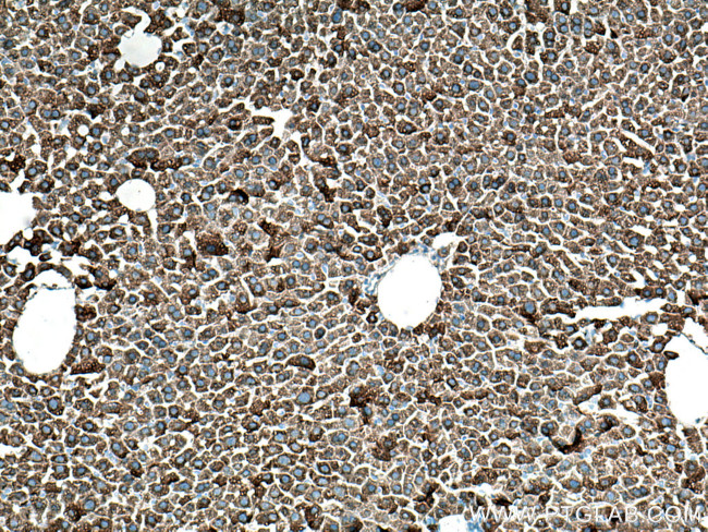 CYP3A4 Antibody in Immunohistochemistry (Paraffin) (IHC (P))