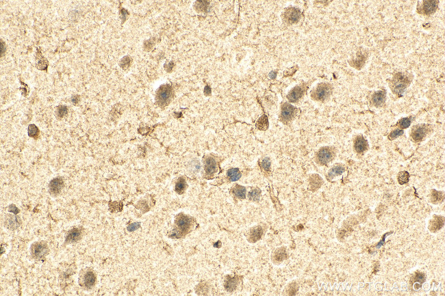 DLX5 Antibody in Immunohistochemistry (Paraffin) (IHC (P))