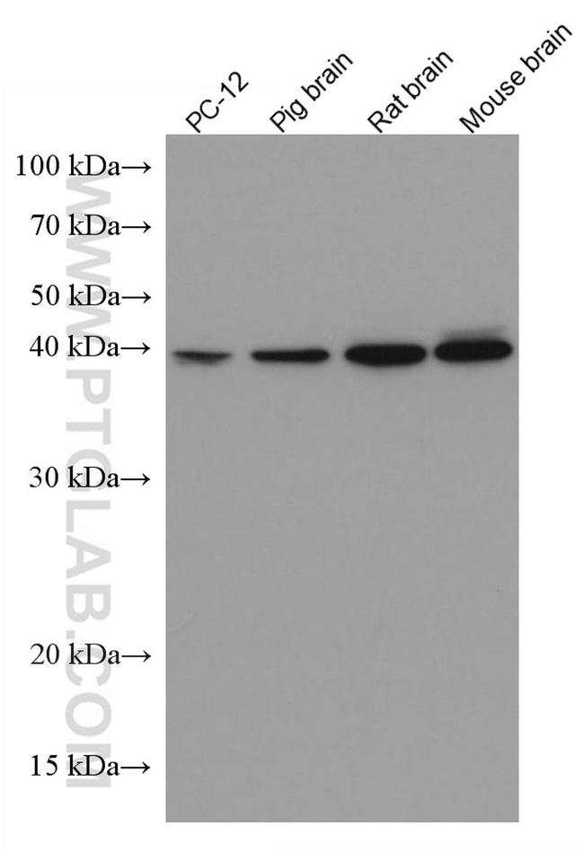 DLX5 Antibody in Western Blot (WB)