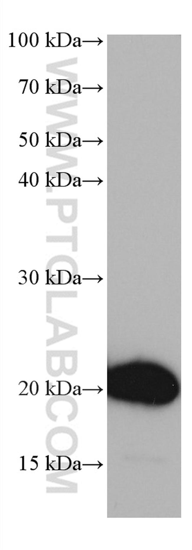 HOXA7 Antibody in Western Blot (WB)