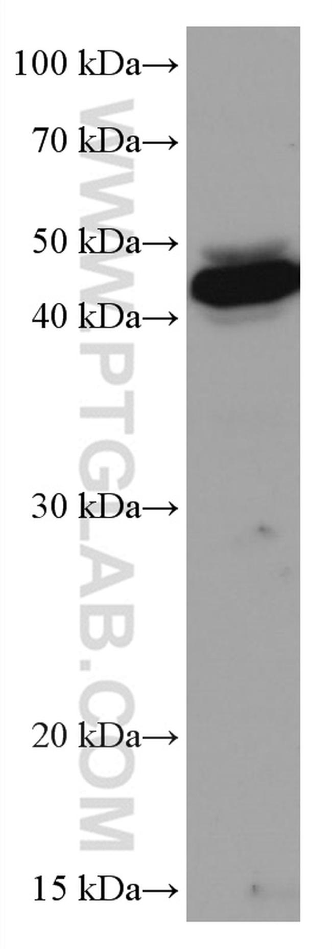 VEGFC Antibody in Western Blot (WB)