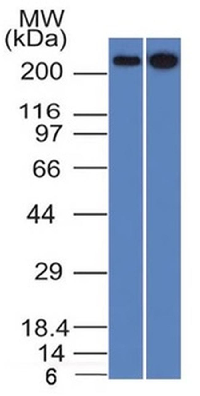 Spectrin beta III (SPTBN2) Antibody in Western Blot (WB)