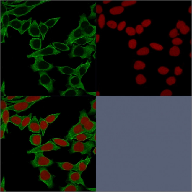 Spectrin beta III (SPTBN2) Antibody in Immunocytochemistry (ICC/IF)