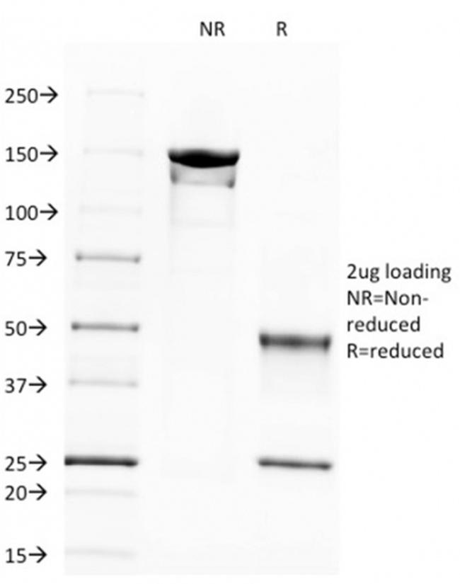 Spectrin beta III (SPTBN2) Antibody in SDS-PAGE (SDS-PAGE)