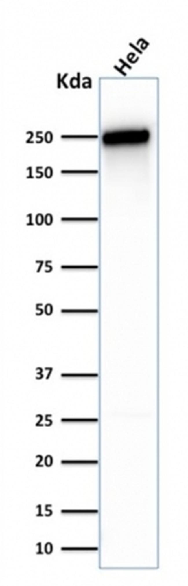 Spectrin beta III (SPTBN2) Antibody in Western Blot (WB)