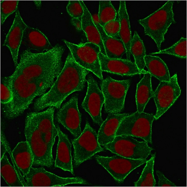 Spectrin beta III (SPTBN2) Antibody in Immunocytochemistry (ICC/IF)