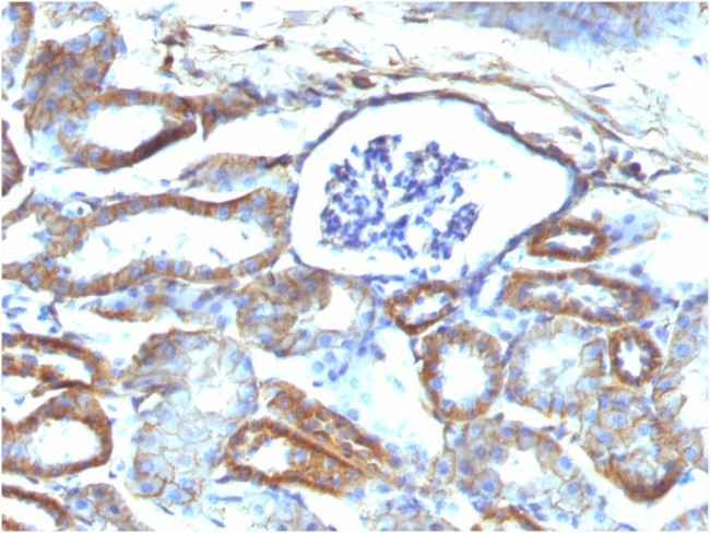 Spectrin beta III (SPTBN2) Antibody in Immunohistochemistry (Paraffin) (IHC (P))