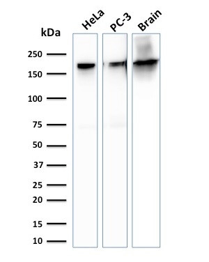 Spectrin beta III (SPTBN2) Antibody in Western Blot (WB)