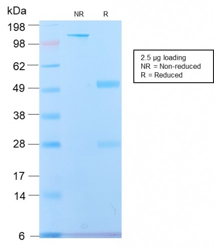 Spectrin beta III (SPTBN2) Antibody in SDS-PAGE (SDS-PAGE)