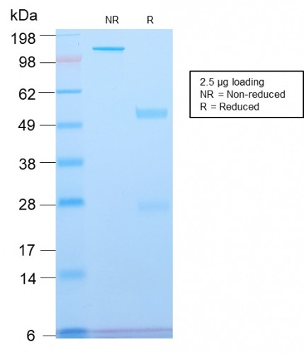 Spectrin beta III (SPTBN2) Antibody in SDS-PAGE (SDS-PAGE)