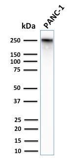 Spectrin beta III (SPTBN2) Antibody in Western Blot (WB)