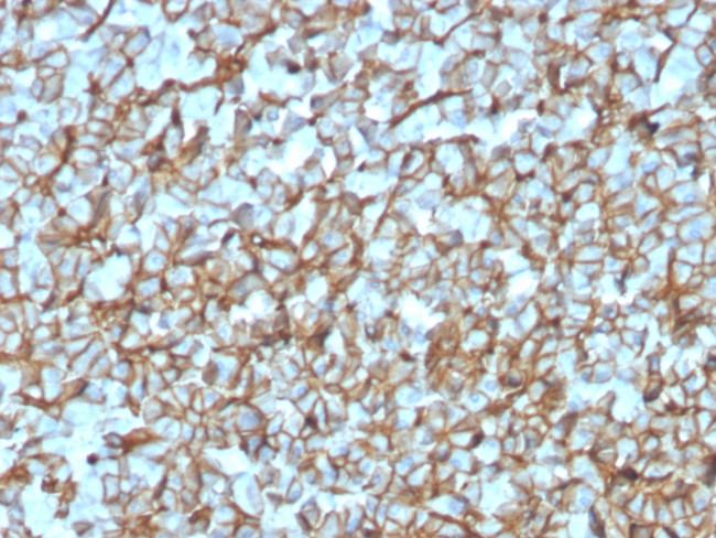 Spectrin beta III (SPTBN2) Antibody in Immunohistochemistry (Paraffin) (IHC (P))