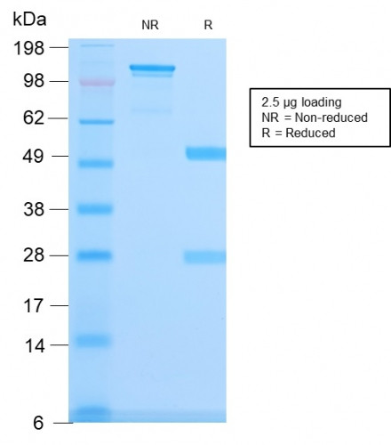 Spectrin beta III (SPTBN2) Antibody in SDS-PAGE (SDS-PAGE)