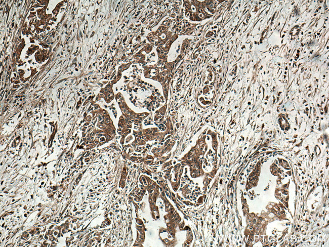 INA Antibody in Immunohistochemistry (Paraffin) (IHC (P))