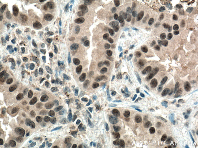 PI3 Kinase p110 Beta Antibody in Immunohistochemistry (Paraffin) (IHC (P))