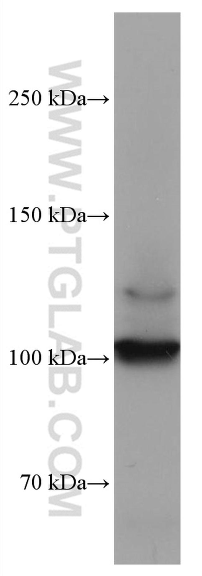 DDR2 Antibody in Western Blot (WB)